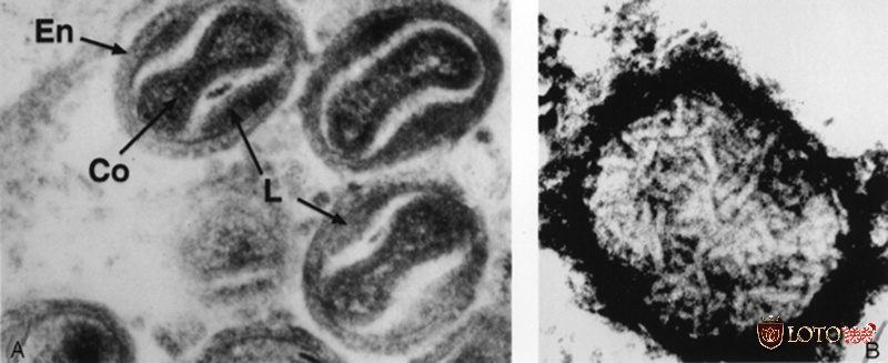 Bệnh thủy đậu ở gà chọi có nguyên nhân chính do virus Fowlpox